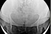 Femeia din Iași se simțea rău și s-a dus la medic. Specialistul a încremenit când a văzut ce apare pe radiografie. „Dumnezeule, e de 30 de ani acolo!” (FOTO) 627004
