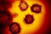 Cum arată coronavirusul văzut la microscop. Microbiologi din întreaga lume încearcă să găsească un vaccin  647405