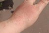 O femeie din Brăila s-a ales cu arsuri pe mâini după ce a folosit dezinfectant la un supermarket 655765