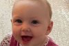 O fetiță a orbit timp de trei zile după ce a căzut cu fața pe un uscător de păr pornit, în Australia 715147