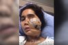 O femeie a supraviețuit după ce a fost împușcată în față de soțul său. Operată de 22 de ori, ea apără acum cauza femeilor din Afganistan 716147