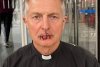 Un preot și-a cusut buzele în semn de protest față de suprimarea informațiilor științifice despre schimbările climatice 720080