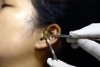 Un ”chirurg” se chinuie să scoată un șarpe viu din urechea unei femei | Clipul a devenit viral 789477