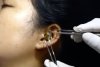 Un ”chirurg” se chinuie să scoată un șarpe viu din urechea unei femei | Clipul a devenit viral 789478