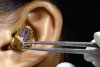 Un ”chirurg” se chinuie să scoată un șarpe viu din urechea unei femei | Clipul a devenit viral 789479