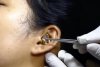 Un ”chirurg” se chinuie să scoată un șarpe viu din urechea unei femei | Clipul a devenit viral 789481