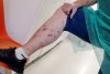 Ciupită de ploșnițe într-un hotel din România | O turistă a ajuns la spital după ce a fost într-o staţiune balneară 790383