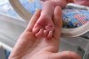 Bebeluş microsom, născut de o româncă de 19 ani la maternitatea din Botoşani 826041