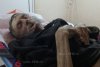 Caz terifiant într-un spital din România! Bărbat adus în stare de putrefacție în timp ce era în viață: “Nu am mai văzut așa ceva” 856568